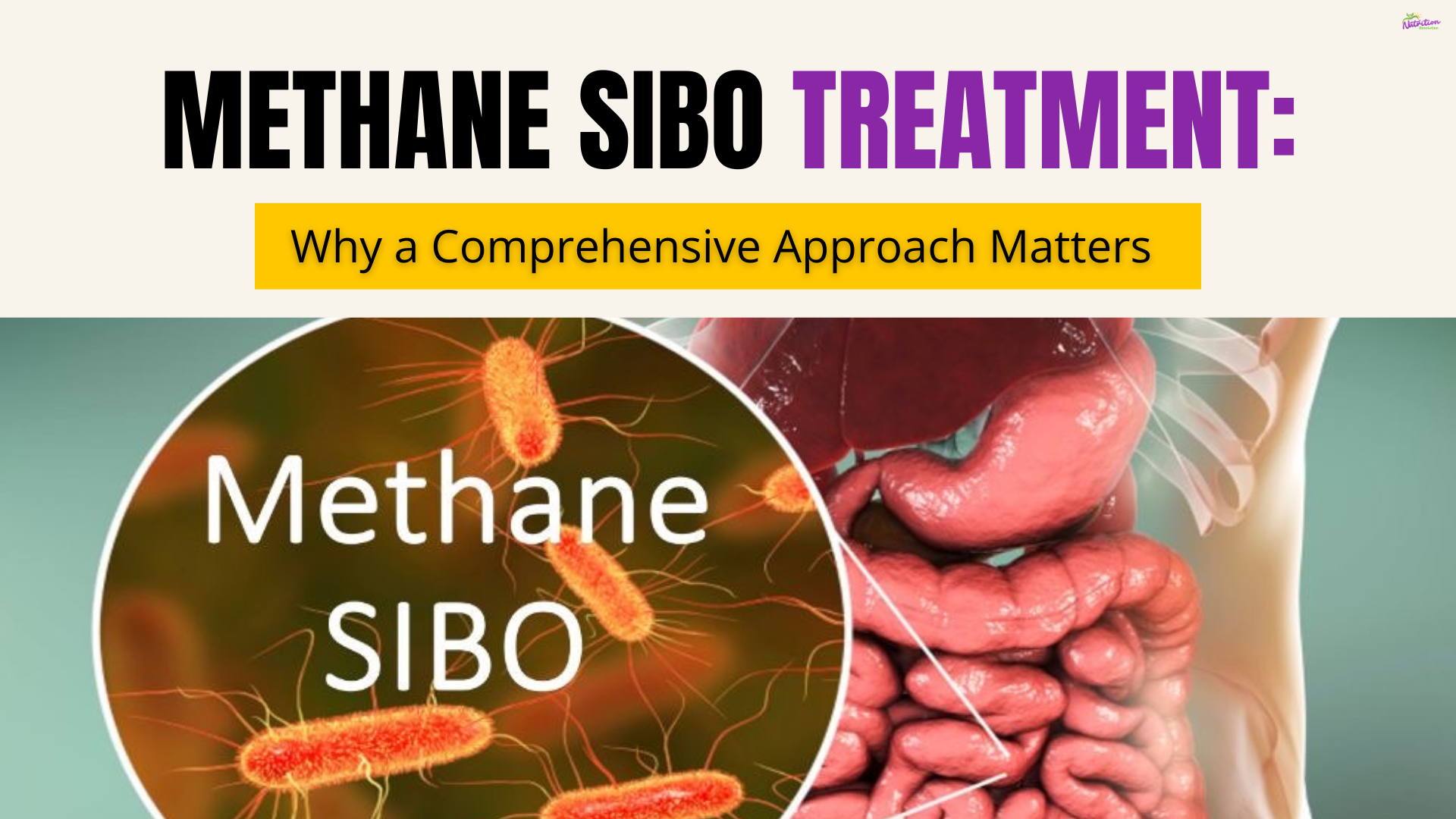 Methane sibo treatment
